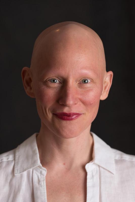What It Means To Be Bald And Beautiful